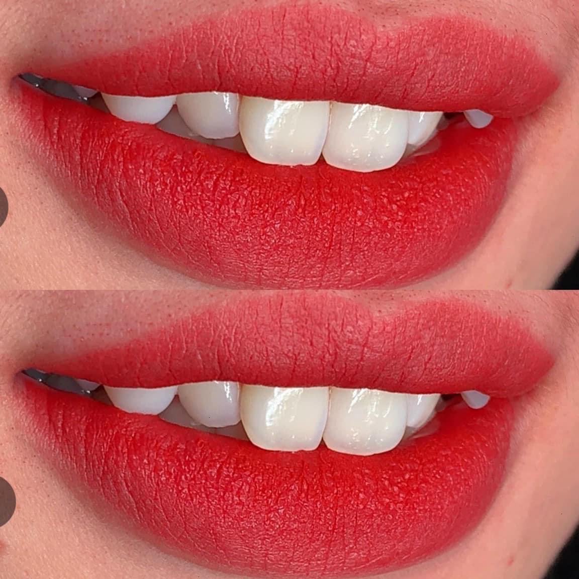 Môi Hồng Đào - 1